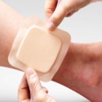 Asia-Pacific Advanced Wound Dressings Market