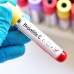 Germany Hepatitis C Testing Market