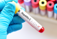 Germany Hepatitis C Testing Market to Reach Market Valuation of USD 135.7 Mn by 2028 Germany Hepatitis C Testing Market