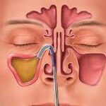 Single-Use Assemblies Market