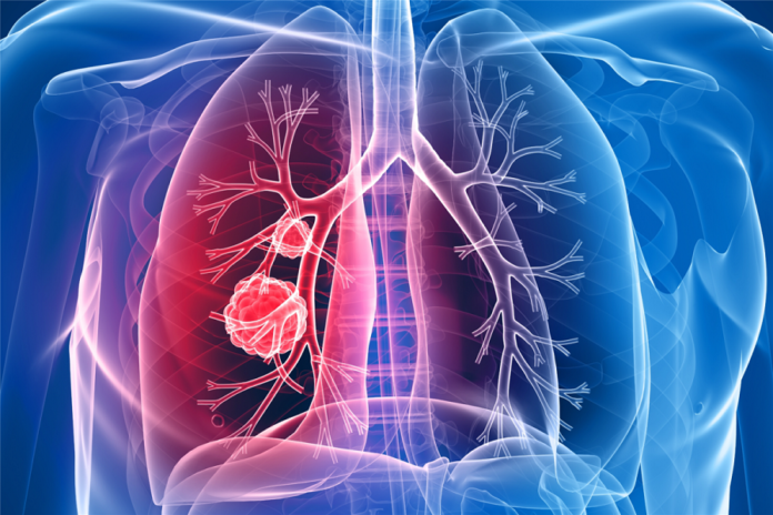 lung cancer genomic testing medicine market