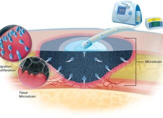 Negative Pressure Wound Therapy Market Size to Cross USD 4 Billion by 2028 Negative pressure wound therapy market