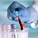 Middle East Liquid Biopsy Market