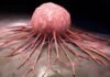Saudi Arabia Solid Tumor Testing Market