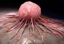 Saudi Arabia Solid Tumor Testing Market to Boom at Steady CAGR of 6.1% During 2023–2029 Saudi Arabia Solid Tumor Testing Market