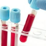 South Africa In Vitro Diagnostic Devices Market