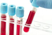 South Africa In Vitro Diagnostic Devices Market Size Set to Touch USD 946 Million by 2029 South Africa In Vitro Diagnostic Devices Market