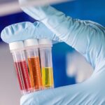Infectious Disease In Vitro Diagnostics Market Size to Reach USD 33 Billion by 2029 Infectious disease in vitro diagnostics market
