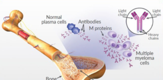 Multiple Myeloma Market Size Grows at Steady CAGR of 5.39% Multiple Myeloma Market